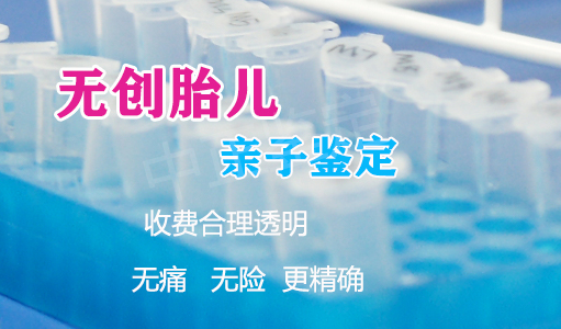 昆山产前亲子鉴定中心结果需要多久,昆山产前亲子鉴定的流程 昆山产前亲子鉴定中心结果需要多久,昆山产前亲子鉴定的流程